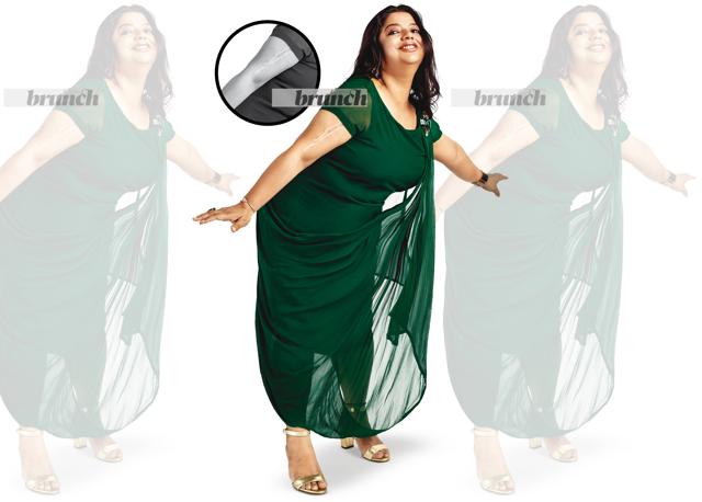 Raashi says she wants the scar to remind her daily of how lucky she is; not everyone gets a second chance; Dress, Monica Rajeev Malik; strap heels, Bata (Shivamm Paathak) Raashi says she wants the scar to remind her daily of how lucky she is; not everyone gets a second chance; Dress, Monica Rajeev Malik; strap heels, Bata (Shivamm Paathak)