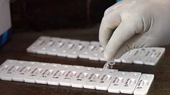 Visitors from Punjab, Haryana, Madhya Pradesh, Gujarat, Kerala nd Maharashtra will need RT-PCR tests to enter Rajasthan.(Representational image/HT PHOTO) Visitors from Punjab, Haryana, Madhya Pradesh, Gujarat, Kerala nd Maharashtra will need RT-PCR tests to enter Rajasthan.(Representational image/HT PHOTO)