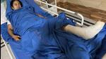 West Bengal chief minister Mamata Banerjee was admitted to SSKM hospital after suffering injuries during her Nandigram visit on Wednesday. (PTI)