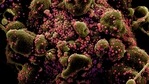 "Usually viruses that jump to a new host species take some time to acquire adaptations to be as capable as Sars-CoV-2 at spreading, and most never make it past that stage, resulting in dead-end spillovers or localised outbreaks," said Sergei Pond, another co-author of the study from Temple University in the US.(Reuters) "Usually viruses that jump to a new host species take some time to acquire adaptations to be as capable as Sars-CoV-2 at spreading, and most never make it past that stage, resulting in dead-end spillovers or localised outbreaks," said Sergei Pond, another co-author of the study from Temple University in the US.(Reuters)