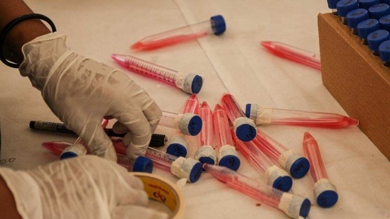 The active cases in the district continued its upward trend to reach 130 from 102 reported on Sunday. (HT Photo) The active cases in the district continued its upward trend to reach 130 from 102 reported on Sunday. (HT Photo)