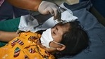 An injured Myanmar refugee receives medical attention at Sop Moei Hospital in Mae Hong Son province on March 30, 2021, after crossing into Thailand via the Salween river following air strikes in Myanmar's Karen state. (Photo by Lillian SUWANRUMPHA / AFP)(AFP) An injured Myanmar refugee receives medical attention at Sop Moei Hospital in Mae Hong Son province on March 30, 2021, after crossing into Thailand via the Salween river following air strikes in Myanmar's Karen state. (Photo by Lillian SUWANRUMPHA / AFP)(AFP)
