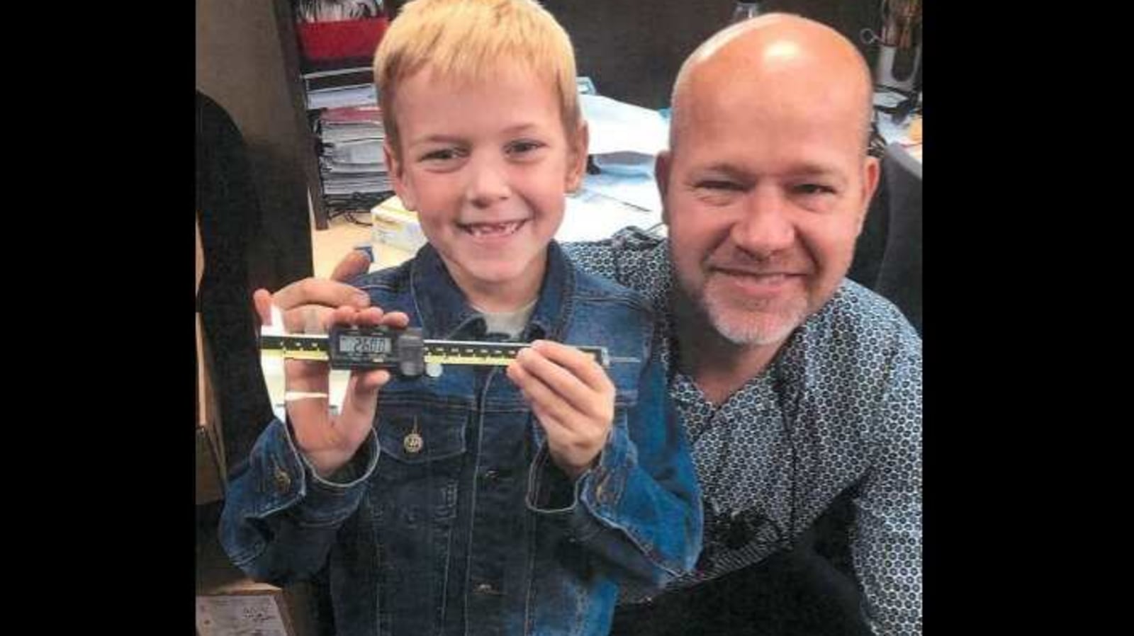 9-year-old Canadian boy bags world record title for longest milk tooth extracted
