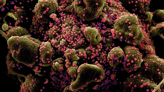Colorized scanning electron micrograph of an apoptotic cell (greenish brown) heavily infected with SARS-COV-2 virus particles (pink), also known as novel coronavirus, isolated from a patient sample.(Reuters File Photo ) Colorized scanning electron micrograph of an apoptotic cell (greenish brown) heavily infected with SARS-COV-2 virus particles (pink), also known as novel coronavirus, isolated from a patient sample.(Reuters File Photo )