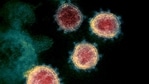 A transmission electron microscopic image that shows SARS-CoV-2 also known as 2019-nCoV, the virus that causes Covid-19, isolated from a patient in the US, as the Virus particles are shown emerging from the surface of cells cultured in the lab- the spikes on the outer edge of the virus particles give coronaviruses their name, crown-like. (AFP)
