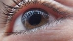 Past studies have shown the condition to continue to worsen even after eye pressure has been controlled.(Pixabay) Past studies have shown the condition to continue to worsen even after eye pressure has been controlled.(Pixabay)
