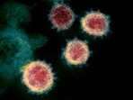 A transmission electron microscopic image that shows SARS-CoV-2 also known as 2019-nCoV, the virus that causes Covid-19, isolated from a patient in the US, as the Virus particles are shown emerging from the surface of cells cultured in the lab- the spikes on the outer edge of the virus particles give coronaviruses their name, crown-like. (AFP)
