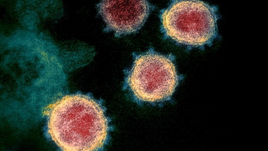 A transmission electron microscopic image that shows SARS-CoV-2 also known as 2019-nCoV, the virus that causes Covid-19, isolated from a patient in the US, as the Virus particles are shown emerging from the surface of cells cultured in the lab- the spikes on the outer edge of the virus particles give coronaviruses their name, crown-like. (AFP) A transmission electron microscopic image that shows SARS-CoV-2 also known as 2019-nCoV, the virus that causes Covid-19, isolated from a patient in the US, as the Virus particles are shown emerging from the surface of cells cultured in the lab- the spikes on the outer edge of the virus particles give coronaviruses their name, crown-like. (AFP)