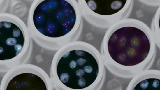 Rare diseases are sometimes the most difficult to treat because of a lack of research and fewer participants to study. (Representational Image) (Unsplash) Rare diseases are sometimes the most difficult to treat because of a lack of research and fewer participants to study. (Representational Image) (Unsplash)