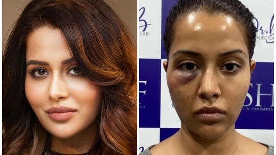Raiza Wilson claimed that she was ‘forced’ to undergo an unnecessary dermatological treatment.