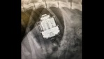 The image shows the x-ray of Jimmy the dog's tummy. The AirPods case can be seen clearly in it.(Facebook/Vets Now) The image shows the x-ray of Jimmy the dog's tummy. The AirPods case can be seen clearly in it.(Facebook/Vets Now)