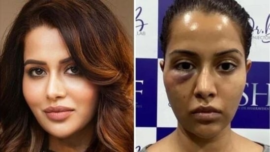 Raiza Wilson's dermatologist responds to her allegations of forced procedure, threatens legal action - Hindustan Times Raiza Wilson's dermatologist responds to her allegations of forced procedure, threatens legal action - Hindustan Times