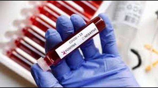 In terms of fresh cases, there was a dip across the tricity, as 1,765 people tested positive, down from an all-time high of 2,201 recorded a day back. In terms of fresh cases, there was a dip across the tricity, as 1,765 people tested positive, down from an all-time high of 2,201 recorded a day back.