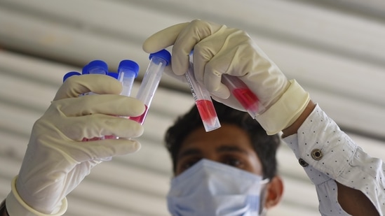 A health worker testing samples collected for Covid-19 testing at Sector 31 Polyclinic in Gurugram.(Vipin Kumar / HT Photo) A health worker testing samples collected for Covid-19 testing at Sector 31 Polyclinic in Gurugram.(Vipin Kumar / HT Photo)