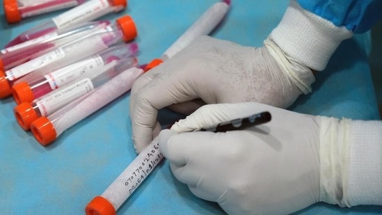 The medical workers in the country have so far tested 286,392,086 samples for the disease, ICMR said.(Bloomberg)