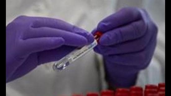 Following the surge, hospitals in J&K have started adding more beds and oxygen plants (AP) Following the surge, hospitals in J&K have started adding more beds and oxygen plants (AP)