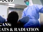 ‘CT-Scans have much less radiation…’: Top doctors explain relevance in Covid