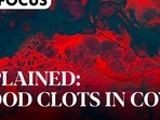 Explained: Blood clots in Covid