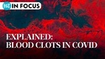 Explained: Blood clots in Covid Explained: Blood clots in Covid
