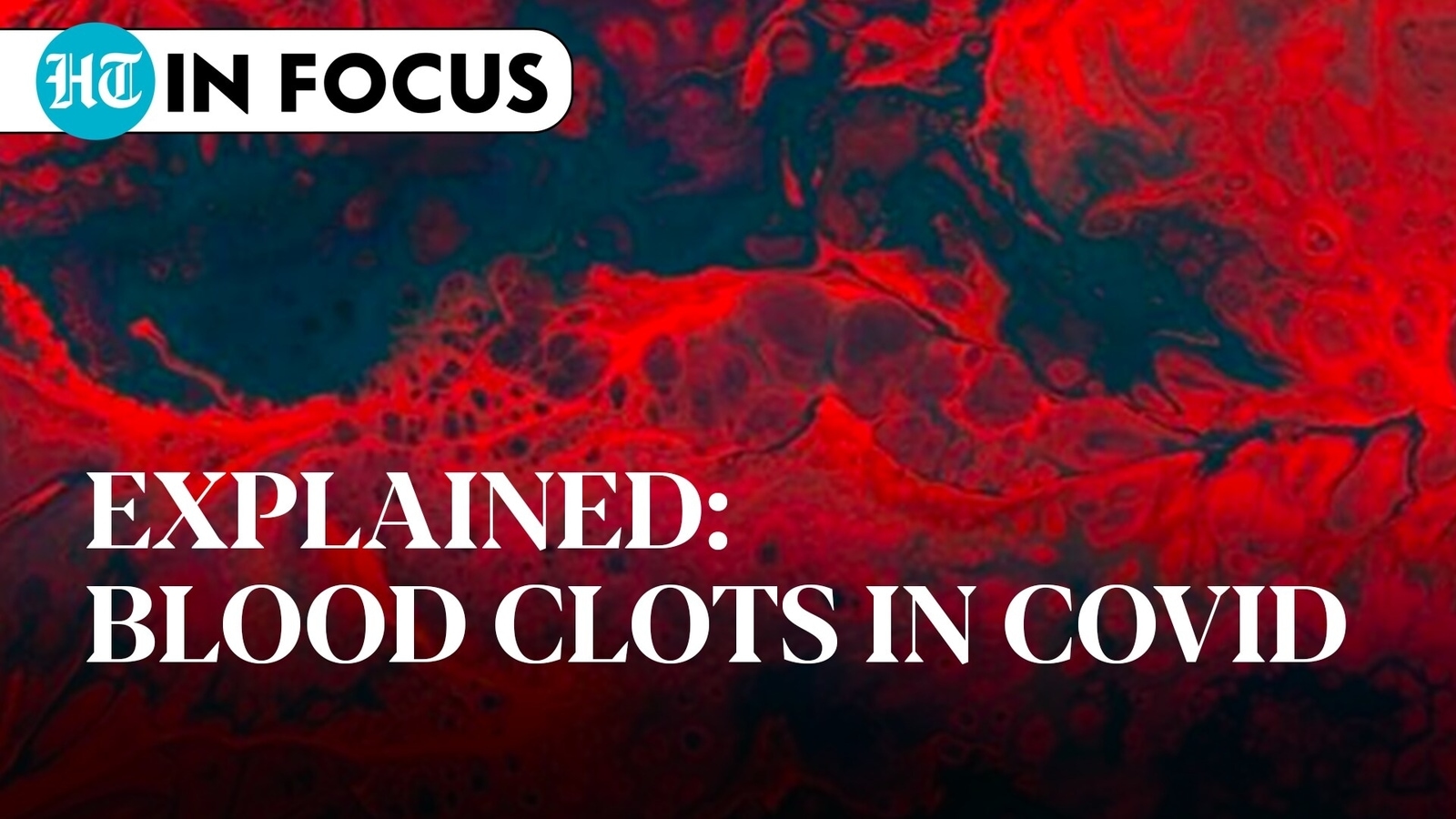 Blood clots in Covid patients Top doctor decodes early signs