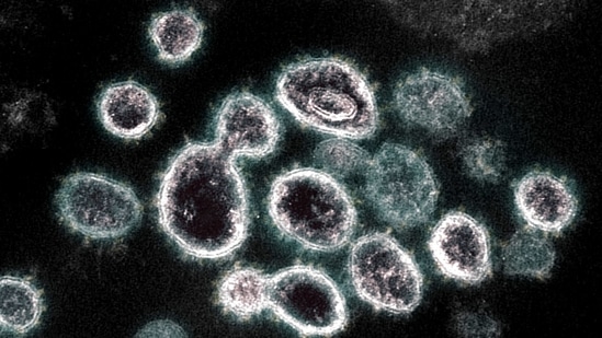 A transmission electron microscope image of SARS-CoV-2, the virus that causes Covid-19, isolated from a patient in the US, as virus particles are shown emerging from the surface of cells cultured in the lab, the spikes on the outer edge of the virus particles give coronaviruses their name, (AFP) A transmission electron microscope image of SARS-CoV-2, the virus that causes Covid-19, isolated from a patient in the US, as virus particles are shown emerging from the surface of cells cultured in the lab, the spikes on the outer edge of the virus particles give coronaviruses their name, (AFP)