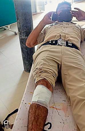 While farmers claimed that over 50 of them sustained injuries in the lathicharge, a government spokesperson said over 20 policemen, including a DSP and five women cops, were also injured. (HT Photo)