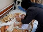 After the strikes, rescue workers pulled the five-month-old from the arms of his dead mother early Saturday, one of his tiny legs fractured in three places. REUTERS/Mohammed Salem