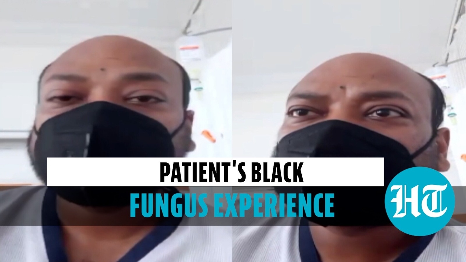 Watch Black Fungus Survivor Recounts Ordeal How He Was Infected Covid Hindustan Times