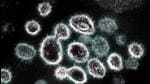 A transmission electron microscope image of Sars-CoV-2, the virus that causes Covid-19. (AFP File) A transmission electron microscope image of Sars-CoV-2, the virus that causes Covid-19. (AFP File)
