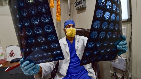 Dr. Ushast Dhir, Senior Consultant of Department of Surgical Gastroenterology and Liver Transplantation at Sir Ganga Ram Hospital, examines the CT scan of a suspected patient infected with mucormycosis, who recently recovered from COVID-19, in New Delhi, on May 27. Active cases are also at their lowest in 54 days, with 16,378 currently battling the virus.(Manvender Vashist / PTI)