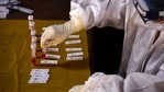 Dr Ram Vishwakarma, advisor to director general, CSIR, said in a screen to identify drugs that can inhibit syncytia formation, Niclosamide was identified as a promising repurposed drug by a research group from King’s College London, which collaborated in the project.(Bachchan Kumar / HT Photo) Dr Ram Vishwakarma, advisor to director general, CSIR, said in a screen to identify drugs that can inhibit syncytia formation, Niclosamide was identified as a promising repurposed drug by a research group from King’s College London, which collaborated in the project.(Bachchan Kumar / HT Photo)