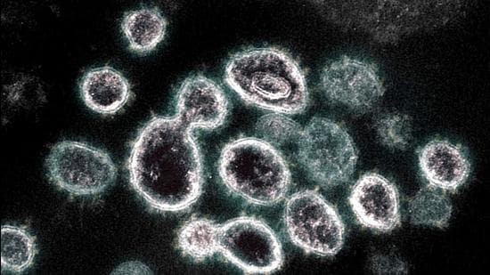 (This file undated handout image obtained March 28, 2021, courtesy of The National Institue of Allergy and Infectious Diseases/ NIH shows a transmission electron microscope image of SARS-CoV-2, the virus that causes Covid-19, isolated from a patient in the US. (AFP)