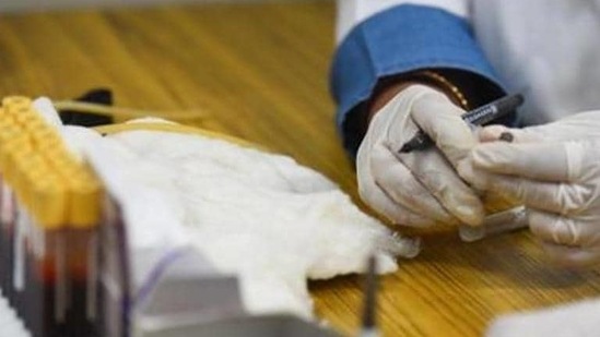 Nearly 10,000 samples collected from across the city over a five-six day period are being processed by researchers from the Maulana Azad Medical College. Nearly 10,000 samples collected from across the city over a five-six day period are being processed by researchers from the Maulana Azad Medical College.