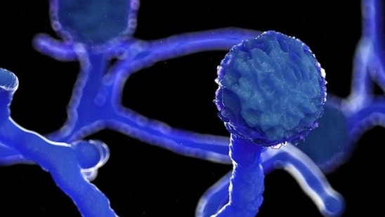 The rising cases of these infections are being attributed to the use of steroids and compromised immunity. Health professionals are being warned to use steroids cautiously and not overdo them. People with uncontrolled diabetes are also prone to these infections. Here's all you need to know about post-COVID-19 fungal infections.(IStock)