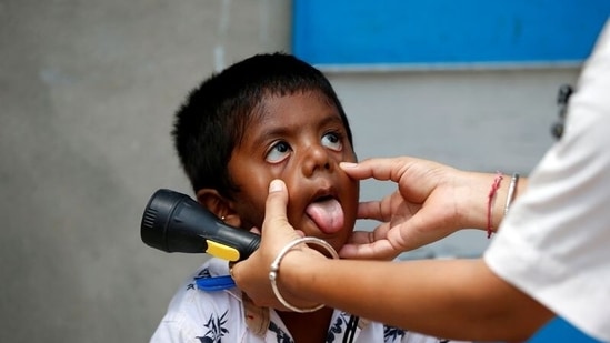 A healthcare worker examines a child during a door-to-door surveillance to safeguard children amidst the spread of the coronavirus disease (COVID-19), at a village on the outskirts of Ahmedabad. (REUTERS)