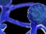 There are 130 suspected cases of mucormycosis, commonly known as black fungus, in the state. Of them, 79 cases have been confirmed, said a senior official at the Chief Minister's Office.