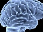 The study considered 2,360 distinct brain measurements.