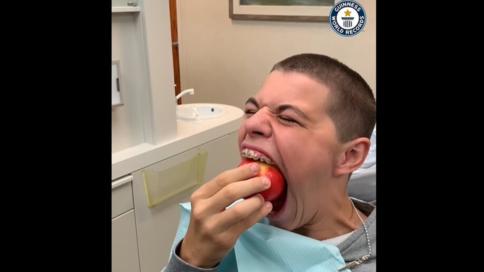 This Us Teen Holds Guinness World Record For Largest Mouth Gape Watch