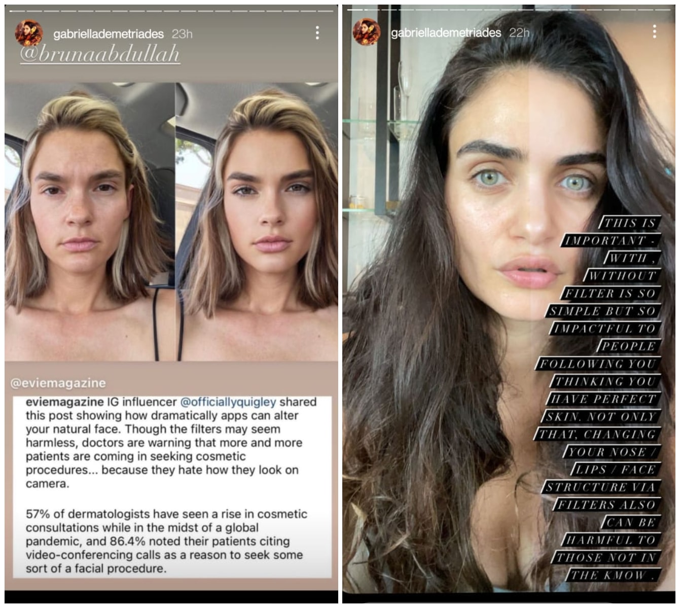 Gabriella Demetriades on Instagram Stories. Gabriella Demetriades on Instagram Stories.