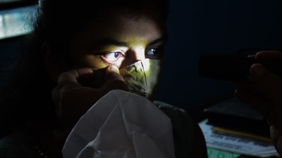 Cases of mucormycosis rose sharply across India during the April-May surge of infections. (HT photo)