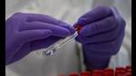 A sero survey examines how many people have been infected with Covid-19 and recovered from it. (AP) A sero survey examines how many people have been infected with Covid-19 and recovered from it. (AP)