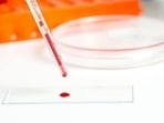 This protein may prevent tumour cells from spreading(Shutterstock) This protein may prevent tumour cells from spreading(Shutterstock)