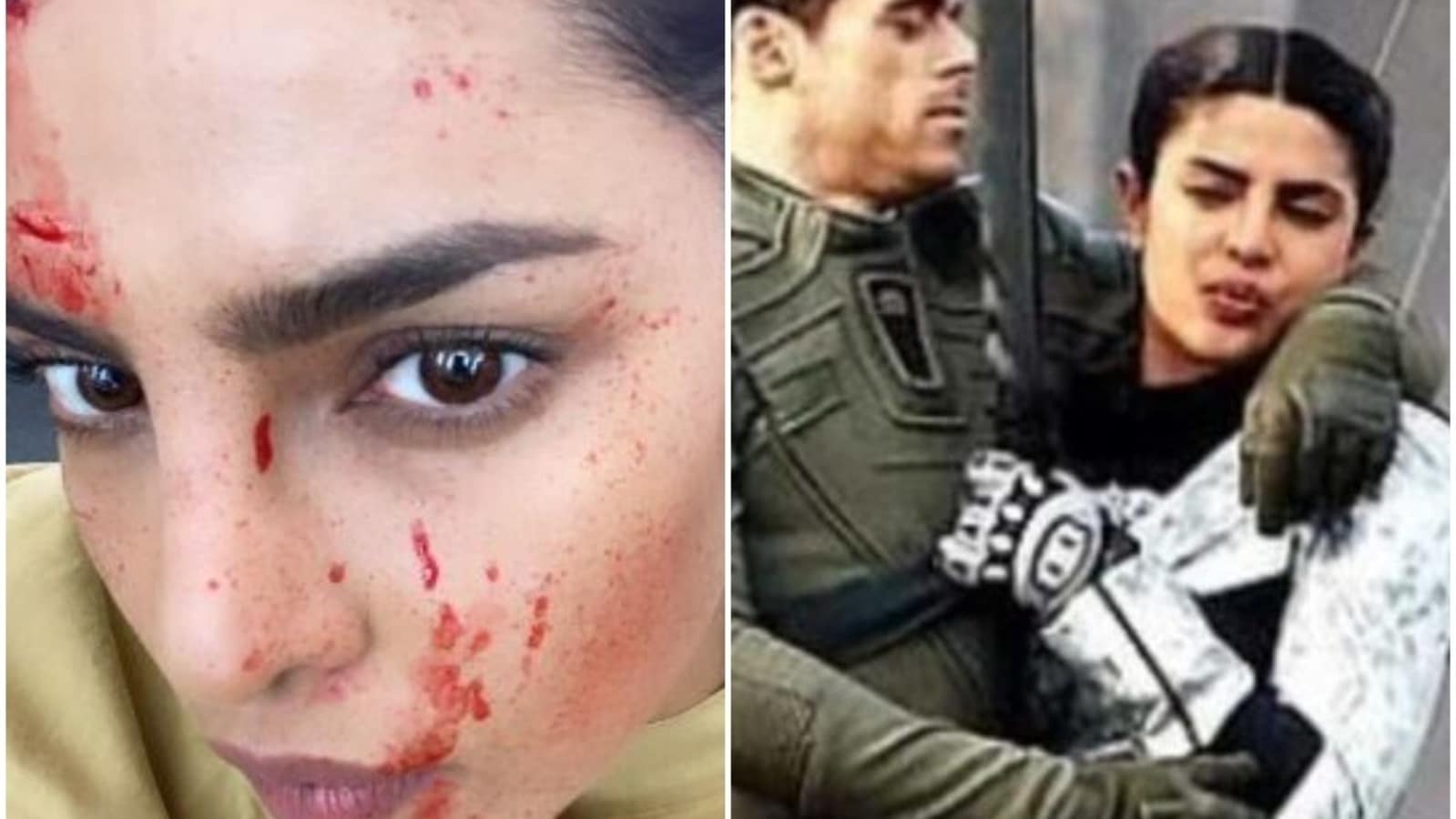 Priyanka Chopra posts alarming bloody-faced selfie, says 'You should see the other guy'. See here