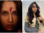 Nora Fatehi was injured while shooting for Bhuj: The Pride of India. Nora Fatehi was injured while shooting for Bhuj: The Pride of India.
