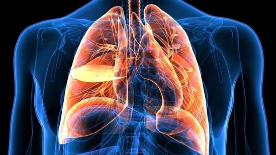 Lung cancer is the uncontrolled growth of abnormal cells that start off in one or both lungs.(Shutterstock) Lung cancer is the uncontrolled growth of abnormal cells that start off in one or both lungs.(Shutterstock)