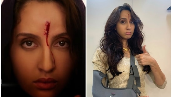 Nora Fatehi’s injury in Bhuj The Pride of India is real, she recalls