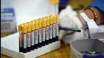 Sero survey is conducted using an antibody test, also known as a serology test. (Raj K Raj/HT Archive) Sero survey is conducted using an antibody test, also known as a serology test. (Raj K Raj/HT Archive)