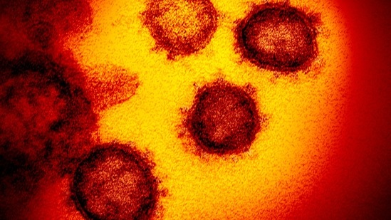 Electron microscope image showing the virus that causes Covid-19(AP) Electron microscope image showing the virus that causes Covid-19(AP)