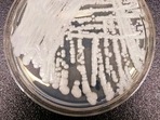 The photo shows a strain of Candida auris cultured in a petri dish at a CDC laboratory.(AP) The photo shows a strain of Candida auris cultured in a petri dish at a CDC laboratory.(AP)