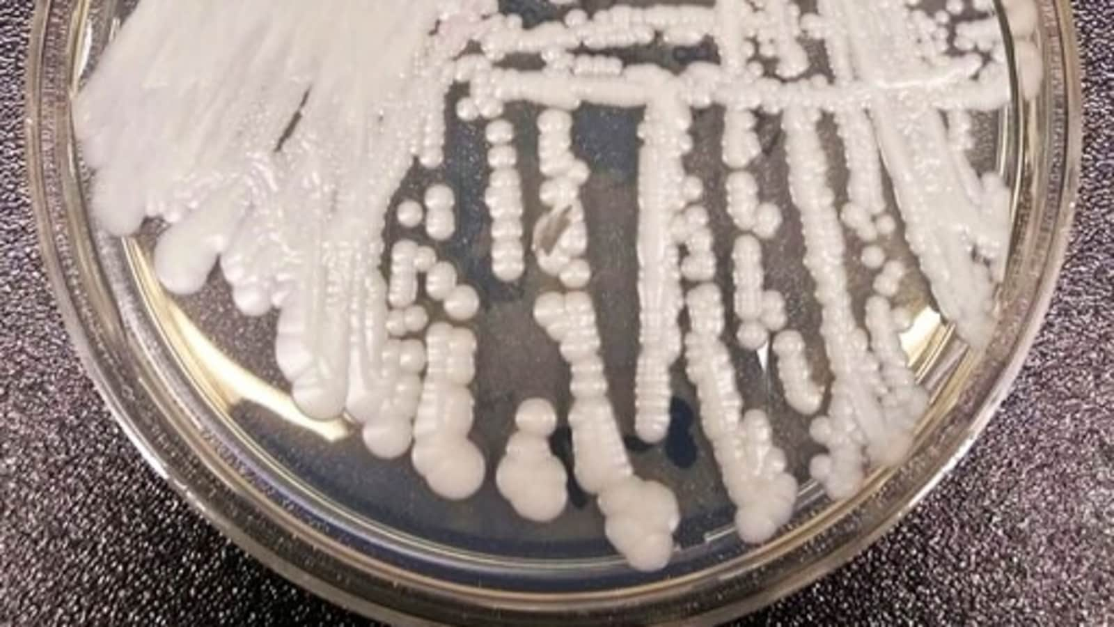 US reports outbreak of 'untreatable' fungus Candida auris. All you need to know